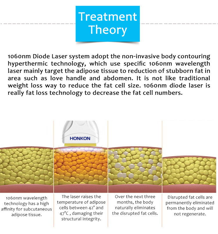 1060-C6 1060nm Diode Laser Body Weight Loss Machine