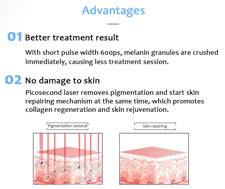 1064pvyl+ High Quality 1064nm & 532nm Picolaser/Picosecond Laser Tattoo Removal Pigmentation Luxurious Equipment