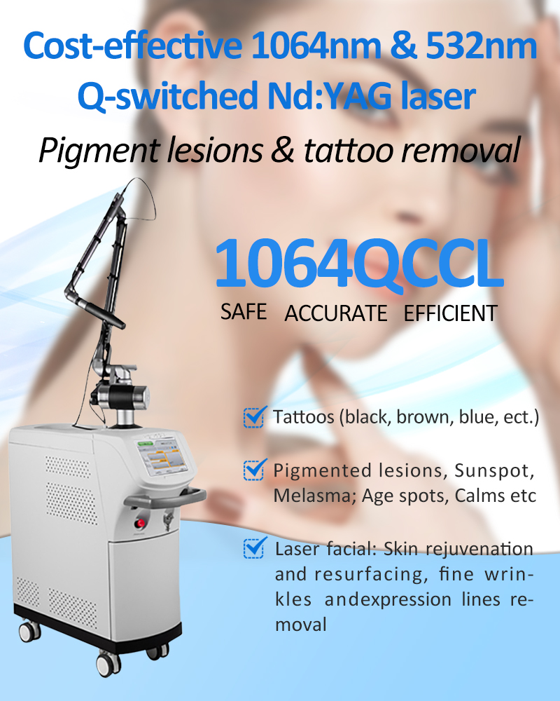 1064nm Q-Switched ND:YAG Lazer, Lazer Tatu Silme Maşın, Piqment Lezyonları Silmə Maşın, 1064QCCL