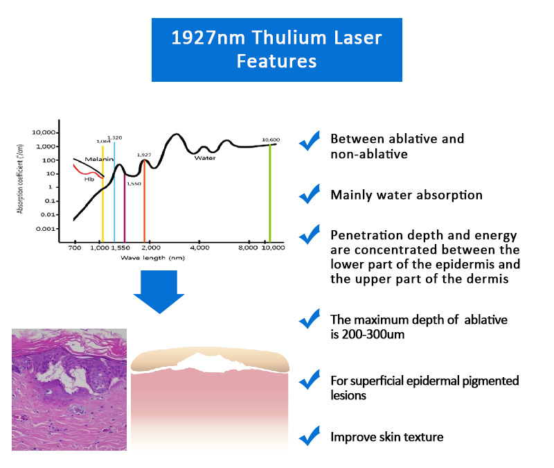 1927nm Thulium Laser, Facial & Skin Resurfacing Machine, Scars & Acne Scars Removal Machine, 1927KK