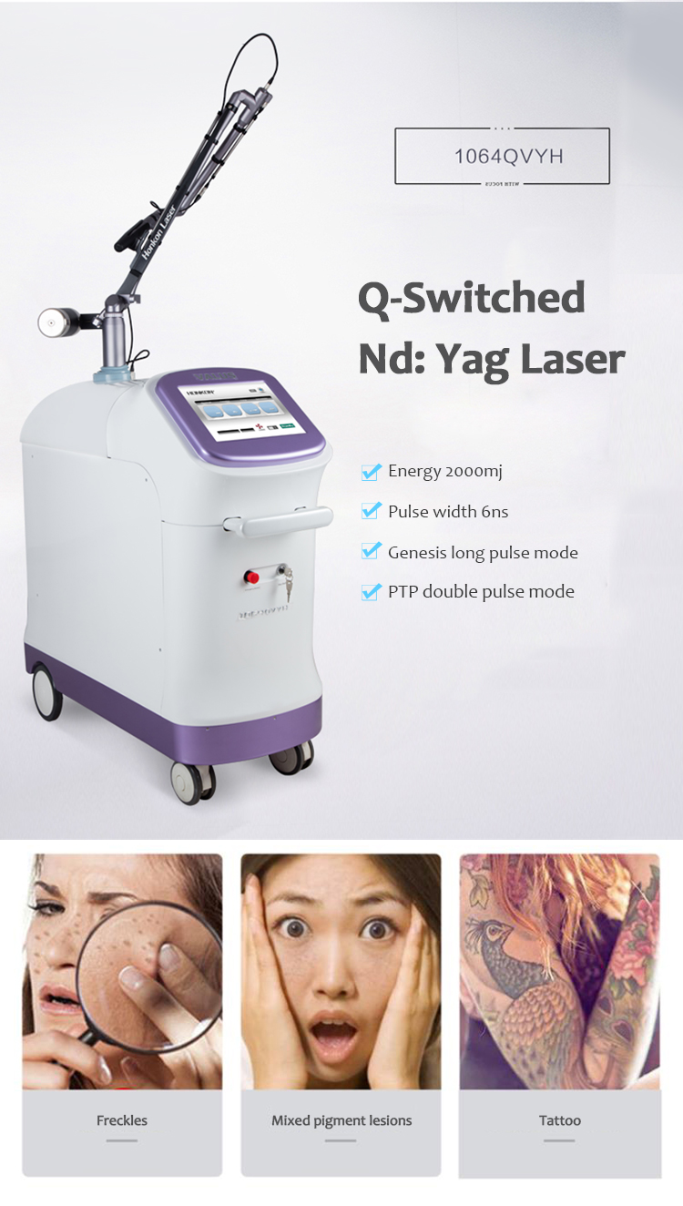 1064QVYH Q-Switched Nd:YAG Máquina de eliminación de lesiones pigmentarias y tatuajes con láser