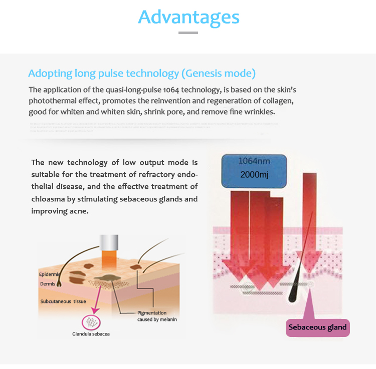 1064QVYH Q-Switched Nd:YAG Máquina de eliminación de lesiones pigmentarias y tatuajes con láser