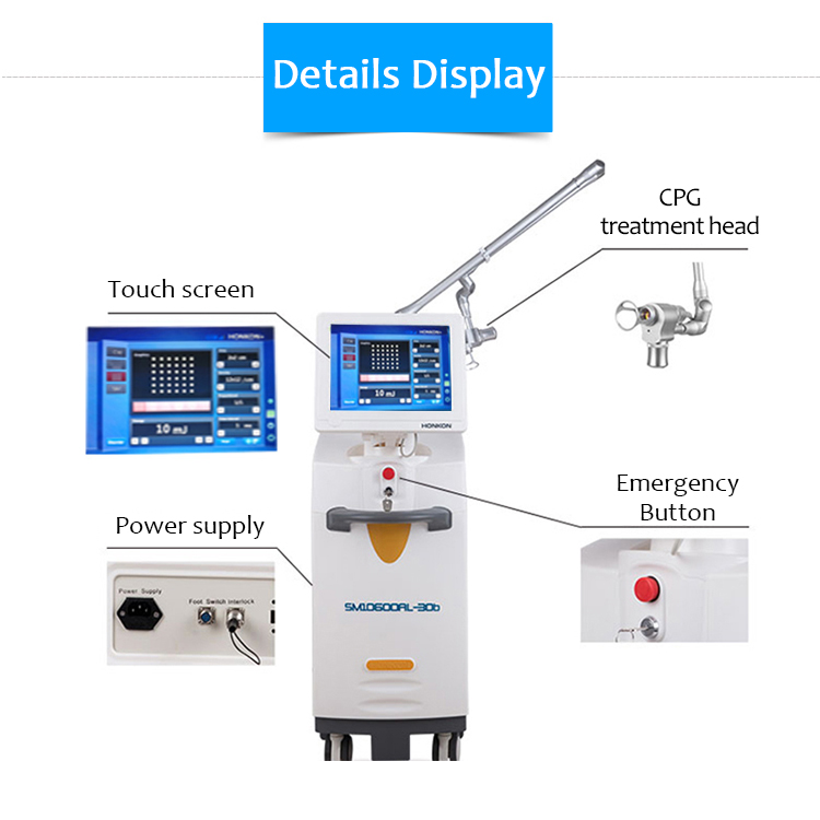 SM10600AL-30b Effektiv 10600nm CO2 Fraksiyalı Lazer Vaginal Daraldan Dərinin Yenilənməsi və Dartma İşarələrinin Təmizlənməsi