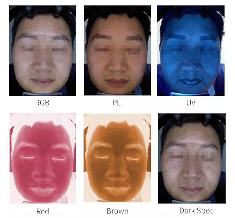 Analizador de piel facial con espejo mágico inteligente portátil de seis espectros BM-20