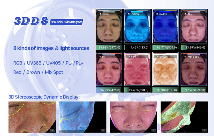 8 түрлі кескіндер мен жарық көздері бар 3D бет терісінің анализаторы