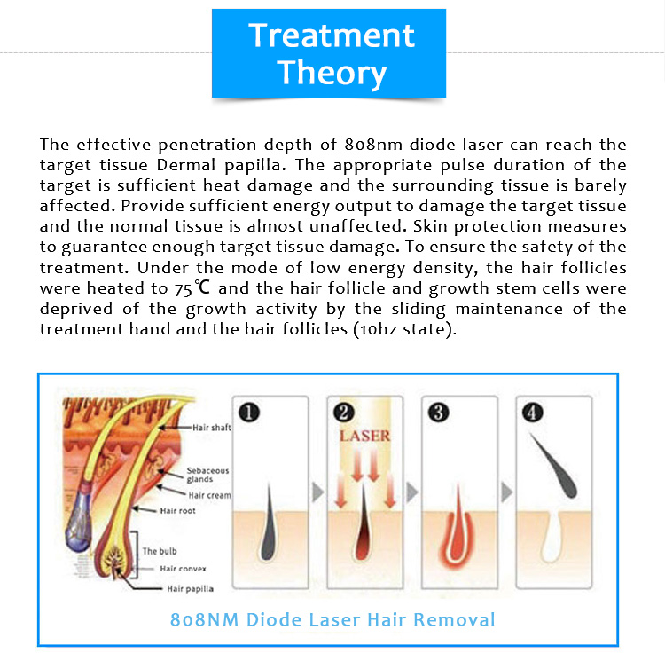 808AL-01 808nm Diode Laser Permanent Hair Removal Machine 