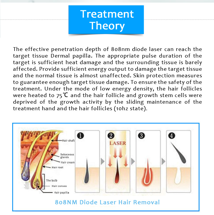 808CL-01 808nm Diode Laser Permanent Hair Removal Machine