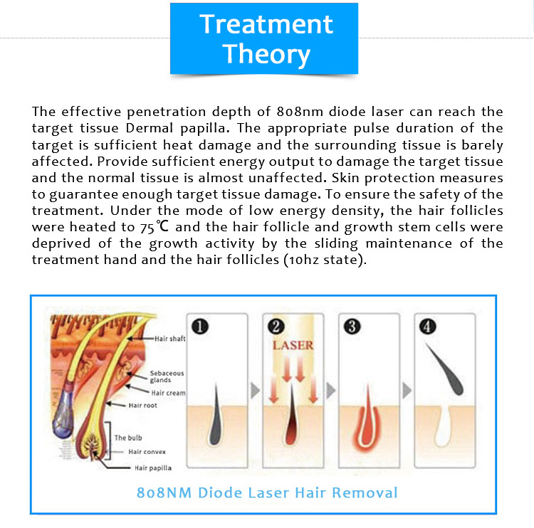 808CUTE03 808nm Diode Laser Permanent Hair Removal Machine