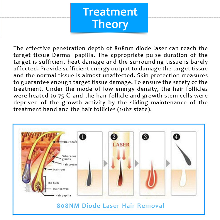 808CUTE 808nm Diode Laser Permanent Hair Removal Machine