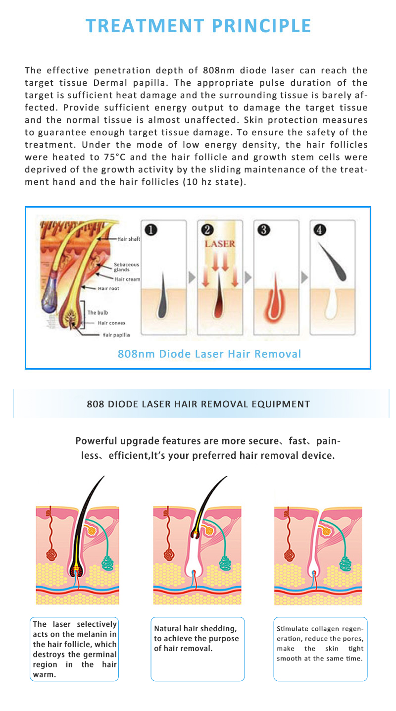 808KK-03 808nm Diode Laser Permanent Hair Removal Skin Rejuvenation Beauty Equipment