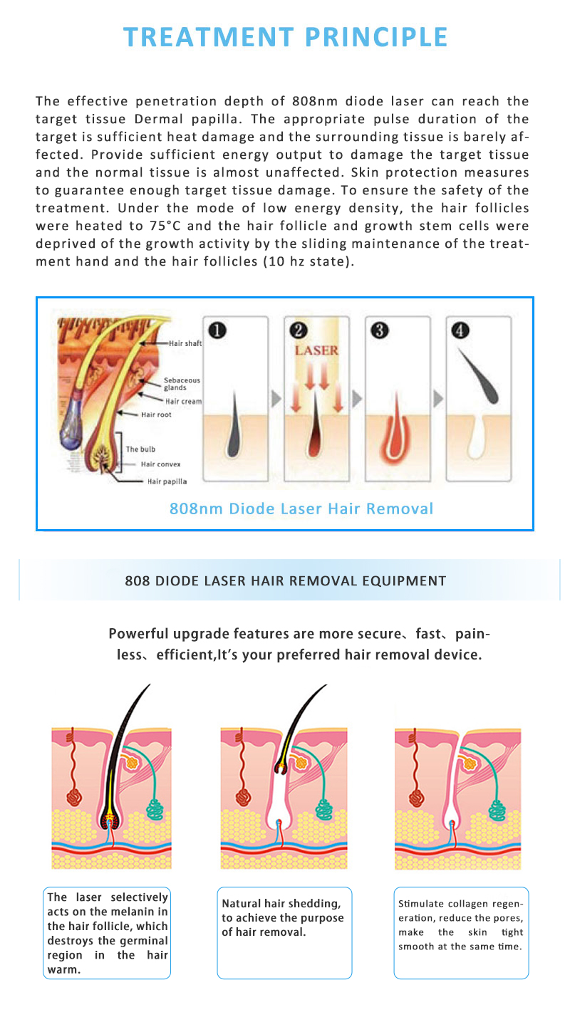 808VEL 808nm Diode Laser Permanent Hair Removal Skin Rejuvenation Machine