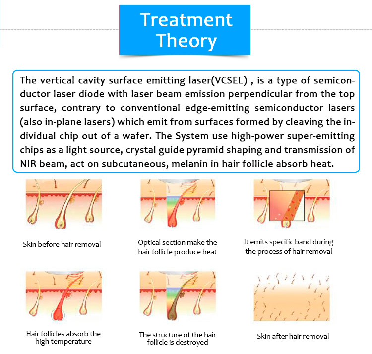 810D04 Non Channel Vertical Cavity Surface Emitting Laser (VCSEL) Hair Removal Machine