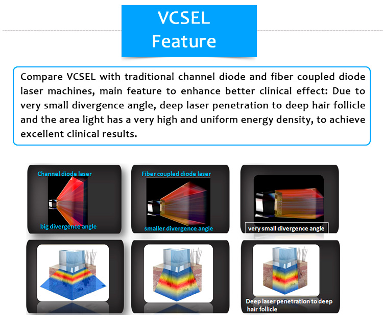 Máquina de depilación láser con emisión de superficie de cavidad vertical sin canal 810D04 (VCSEL)