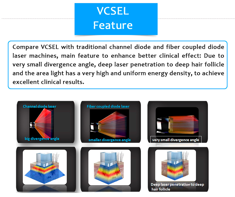 Máquina de depilación láser con emisión de superficie de cavidad vertical sin canal 810D02 (VCSEL)