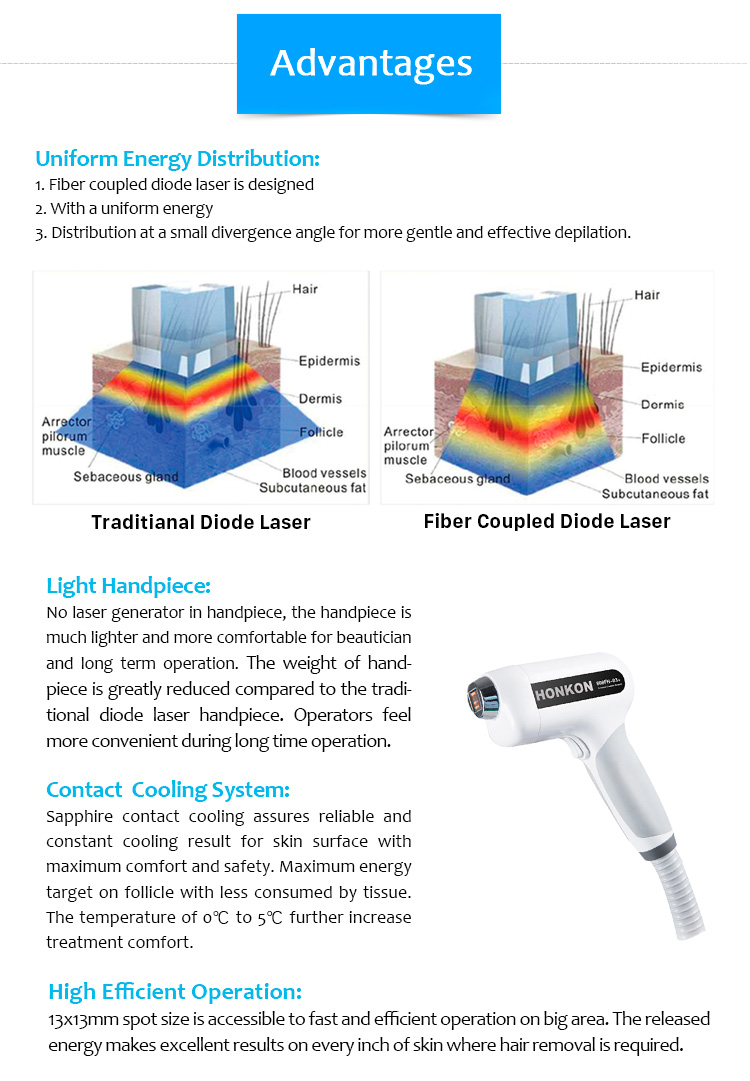 Láser de diodo acoplado de fibra 810Fiber-C 810 para máquina de depilación