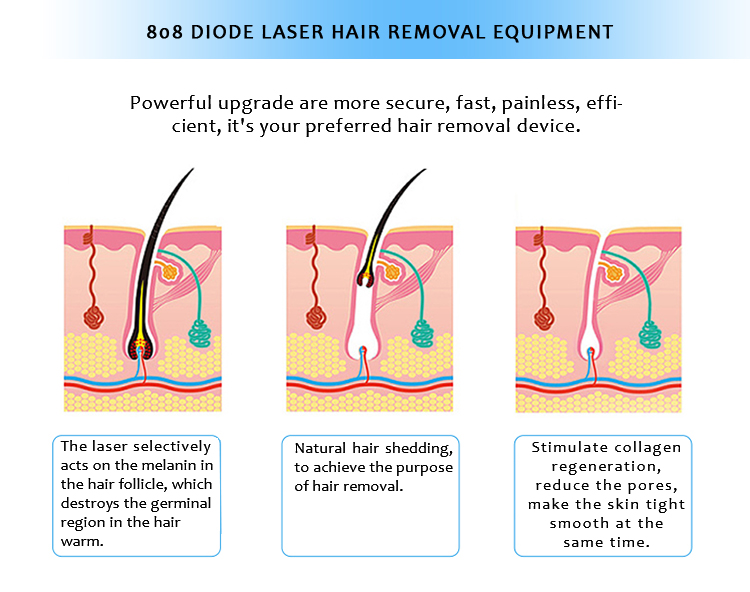 DL9999 808nm Diode Laser Permanent Hair Removal Machine 