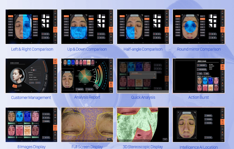 8 төрлийн зураг, гэрлийн эх үүсвэр бүхий 3D нүүрний арьсны анализатор