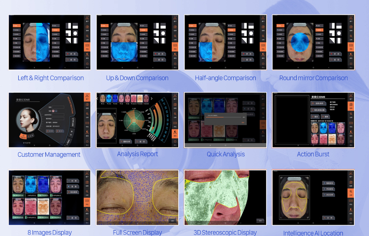 8 түрлі кескіндер мен жарық көздері бар 3D бет терісінің анализаторы