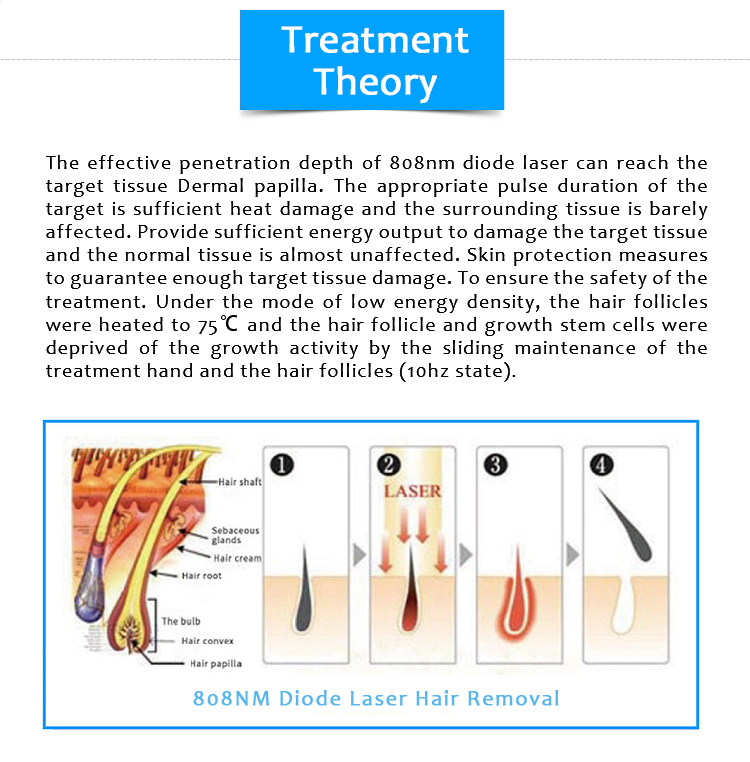 DL9999 808nm Diode Laser Permanent Hair Removal Machine 