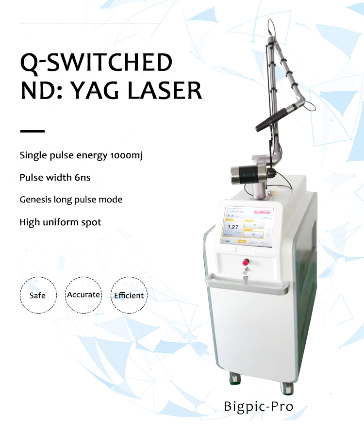 1064 нм Q-Switched ND: YAG лазері, лазерлік татуировканы кетіру машинасы, Bigpic-pro