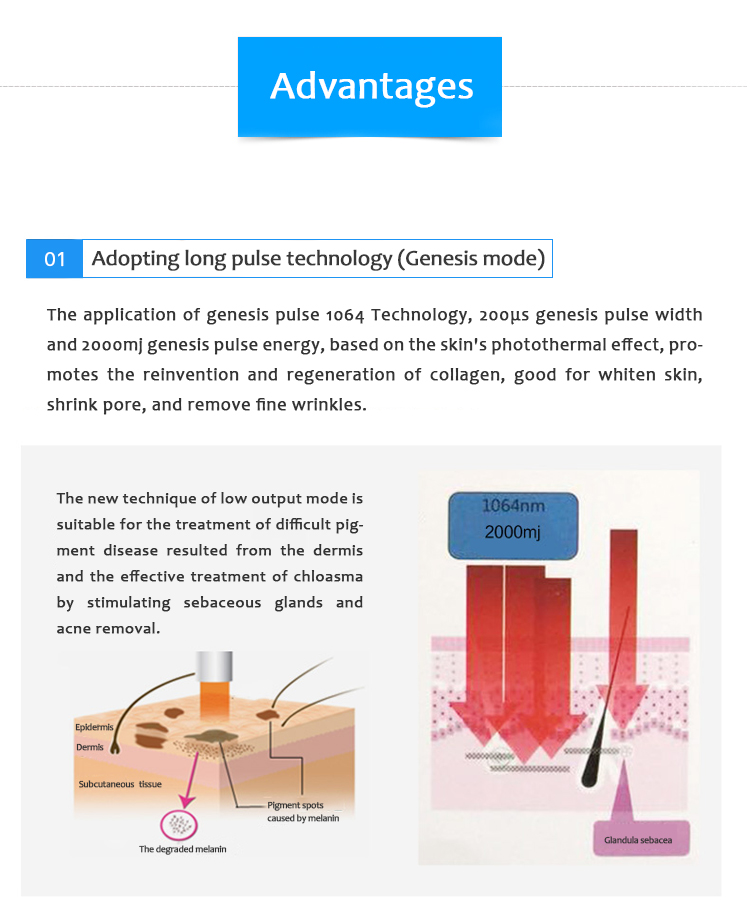 Láser ND:YAG con conmutación Q de 1064 nm, máquina de eliminación de tatuajes con láser, Bigpic-pro