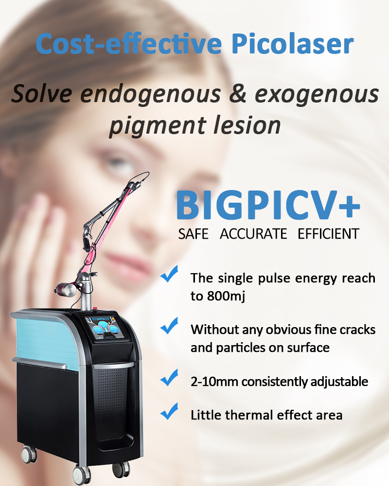 Bigpic V+ Effektiv Pikolazer/Pikosaniyəlik Lazer Piqment Lezyonları Tatu Silmə Maşını