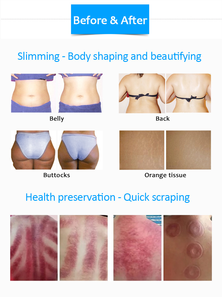 Healtech-VII Slimming Magic Skin Tightening Reduce Cellulite Machine