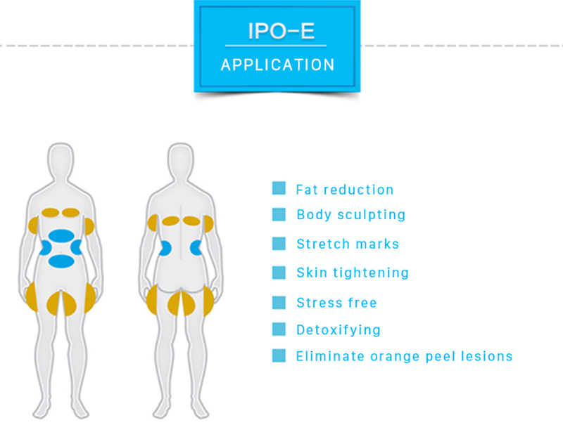 IPO-E Cryolipolysis Arıqlama Maşını Cryolipolysis Cihazı Kriyolipoliz Cihazı