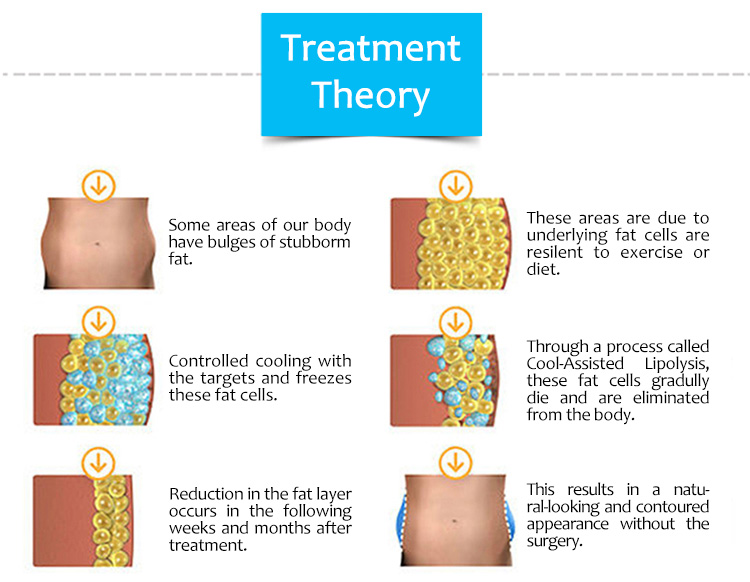 Body Slimming & Cryolipolysis, Body Slimming Machine, Cryolipolysis Machine, Skin Tightening Machine, Weight Loss Machine, IPO-W01