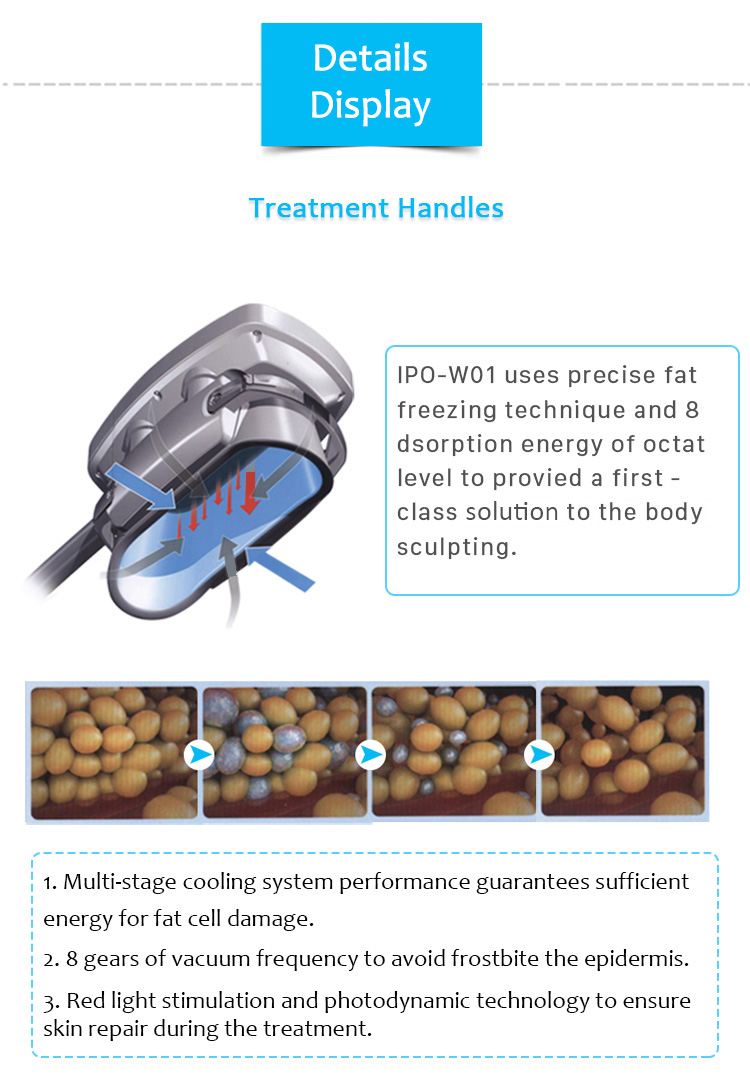 Adelgazamiento corporal y criolipólisis, Máquina de adelgazamiento corporal, Máquina de criolipólisis, Máquina para reafirmar la piel, Máquina para bajar de peso, IPO-W01