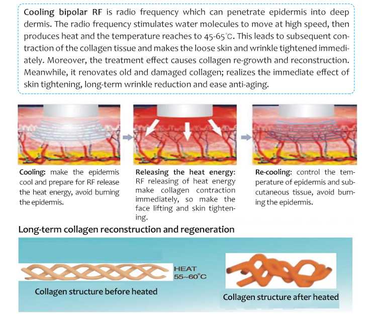 M90e Ipl/E-Light Hair Removal Skin Rejuvenation Bipolar Rf Skin Tightening And Lifting 