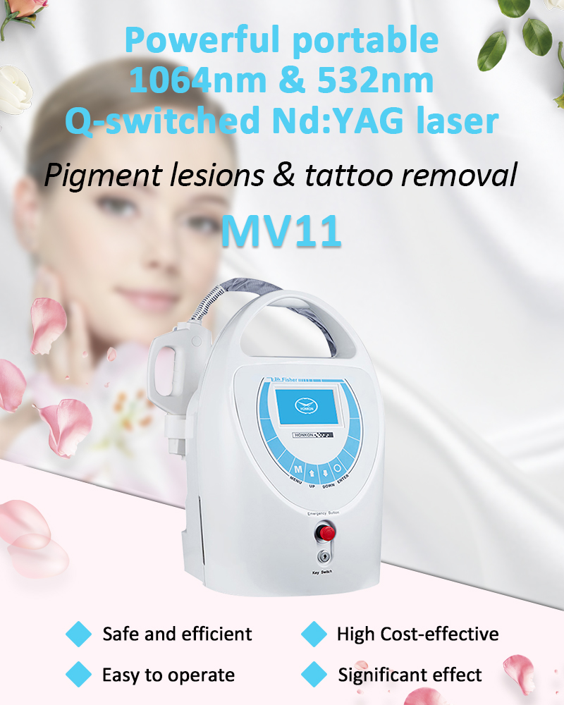 1064 nm Q-Switched ND:YAG lāzers, lāzera tetovējumu noņemšanas iekārta, pigmentu bojājumu noņemšanas iekārta, MV11