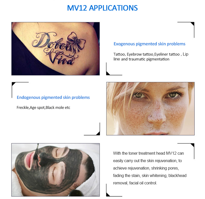 MV12 Mini Q-Switched Nd:YAG Láser Lesiones pigmentarias y eliminación de tatuajes Rejuvenecimiento de la piel Máquina de salón de belleza