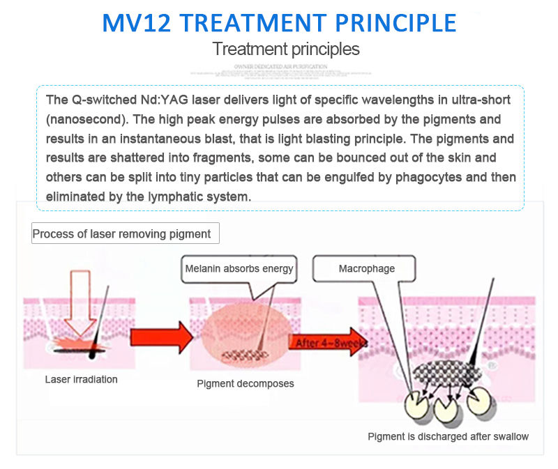 MV12 Mini Q-Switched Nd:YAG лазер пигмент гэмтэл, шивээс арилгах арьс залуужуулах гоо сайхны салоны машин