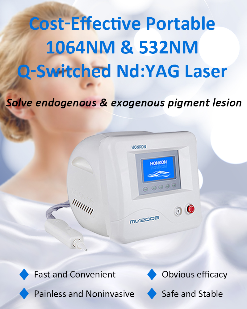 Láser ND:YAG con conmutación Q de 1064 nm, máquina de eliminación de tatuajes con láser, máquina de eliminación de lesiones pigmentarias, MV2008