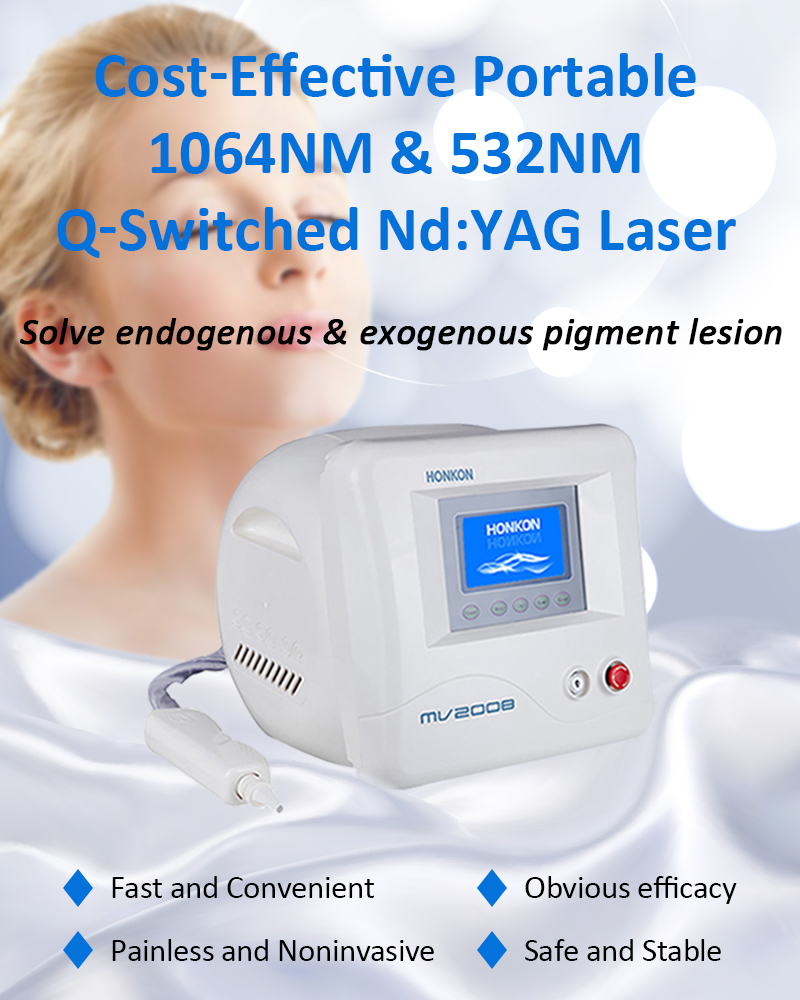 1064nm Q-Switched ND:YAG Lazer, Lazer Tatu Silme Maşın, Piqment Lezyonları Silmə Maşın, MV2008