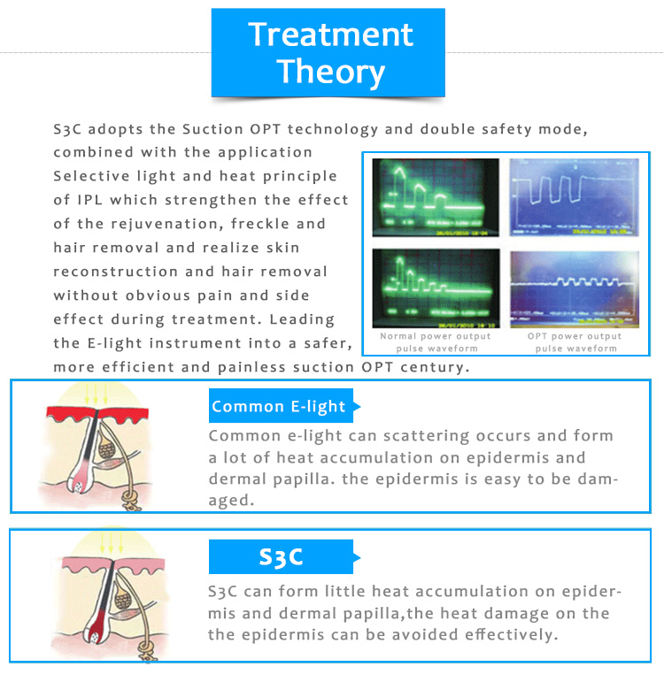 S3C IPL/OPT/SHR Suction Hair Removal Skin Rejuvenation Pigmentation & Vascular Lesion Machine