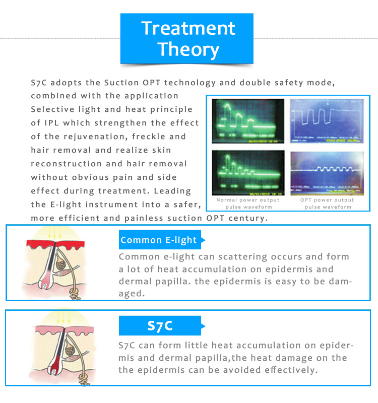 Máquina de depilación permanente S7C IPL/OPT/SHR, rejuvenecimiento de la piel, pigmentación y lesiones vasculares