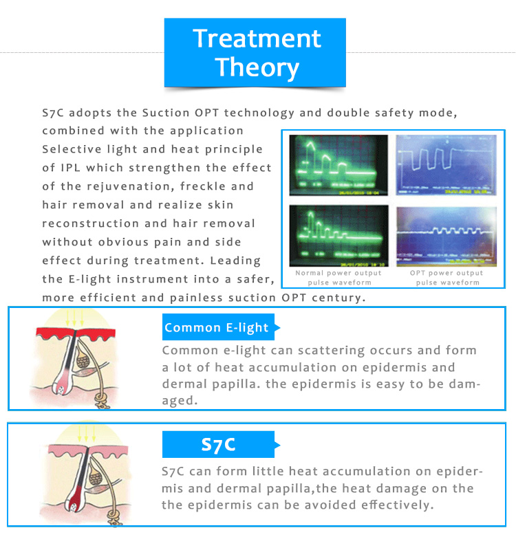 S7C IPL/OPT/SHR Մշտական ​​էպիլյացիա Մաշկի երիտասարդացում պիգմենտացիայի և անոթային վնասվածքների մեքենա