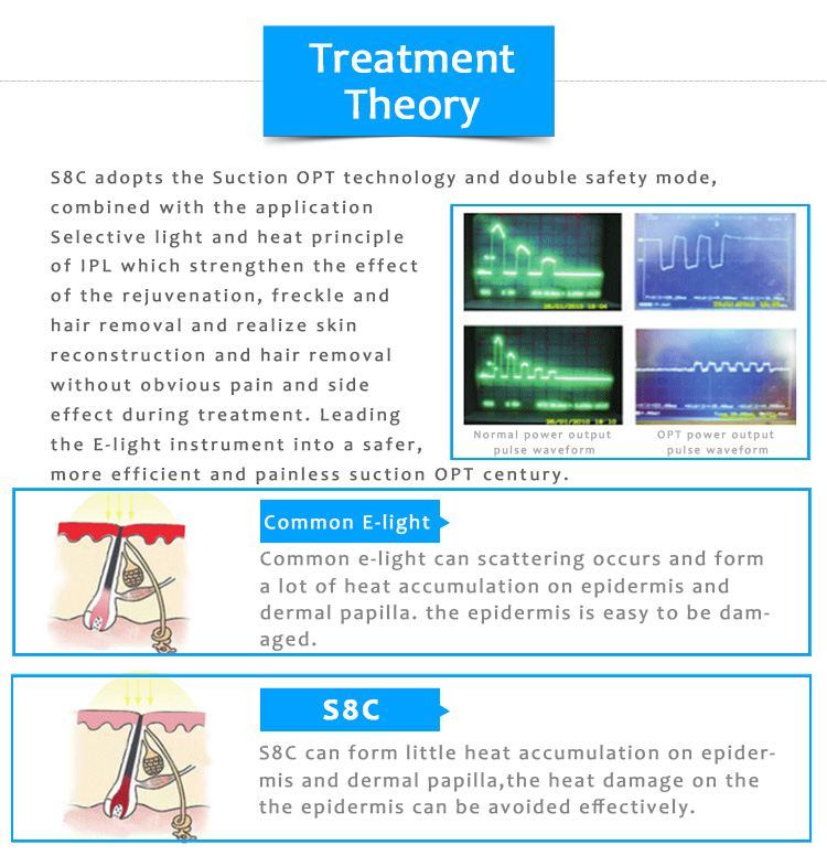 S8C Permanent Hair Removal Skin Rejuvenation Pigmentation & Vascular Lesion IPL/OPT/SHR Beauty Machine
