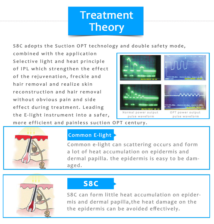 Máquina de belleza IPL/OPT/SHR para depilación permanente S8C, rejuvenecimiento de la piel, pigmentación y lesiones vasculares