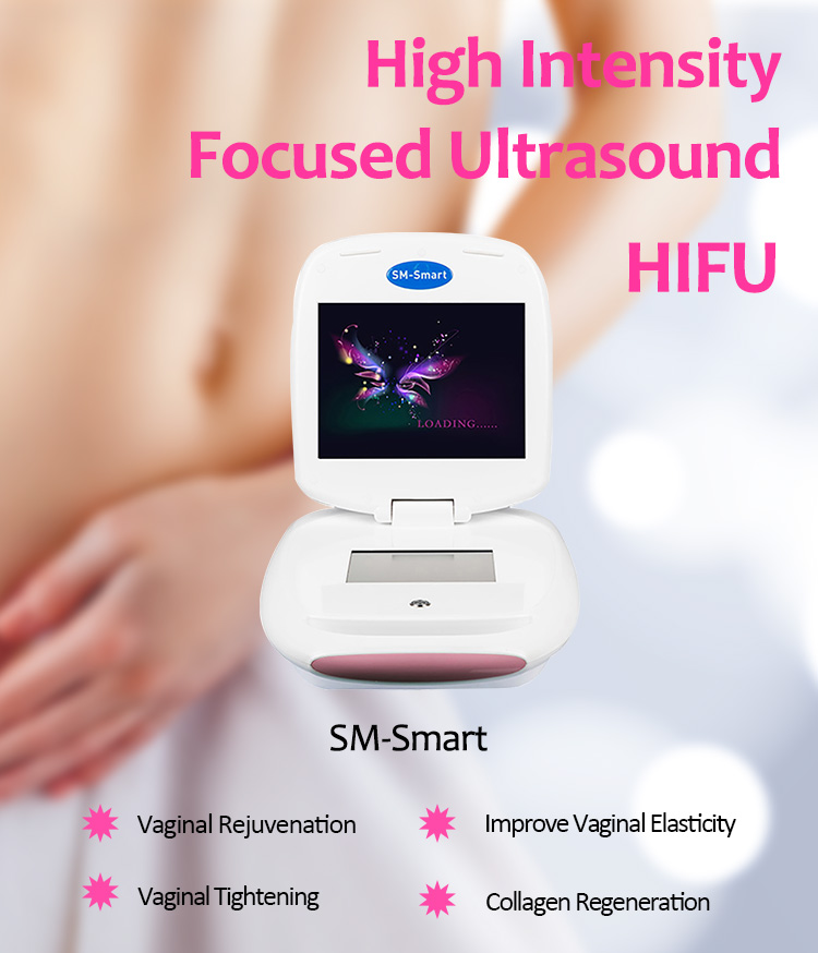 SM-Smart Portativ HIFU Vaginal Dartıcı Qeyri-İnvaziv Vaginal Müalicə Gözəllik Maşını