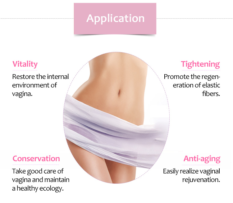 SM-Smart Portable HIFU Vaginal Tightening Non-Invasive Vaginal Treatment Beauty Machine