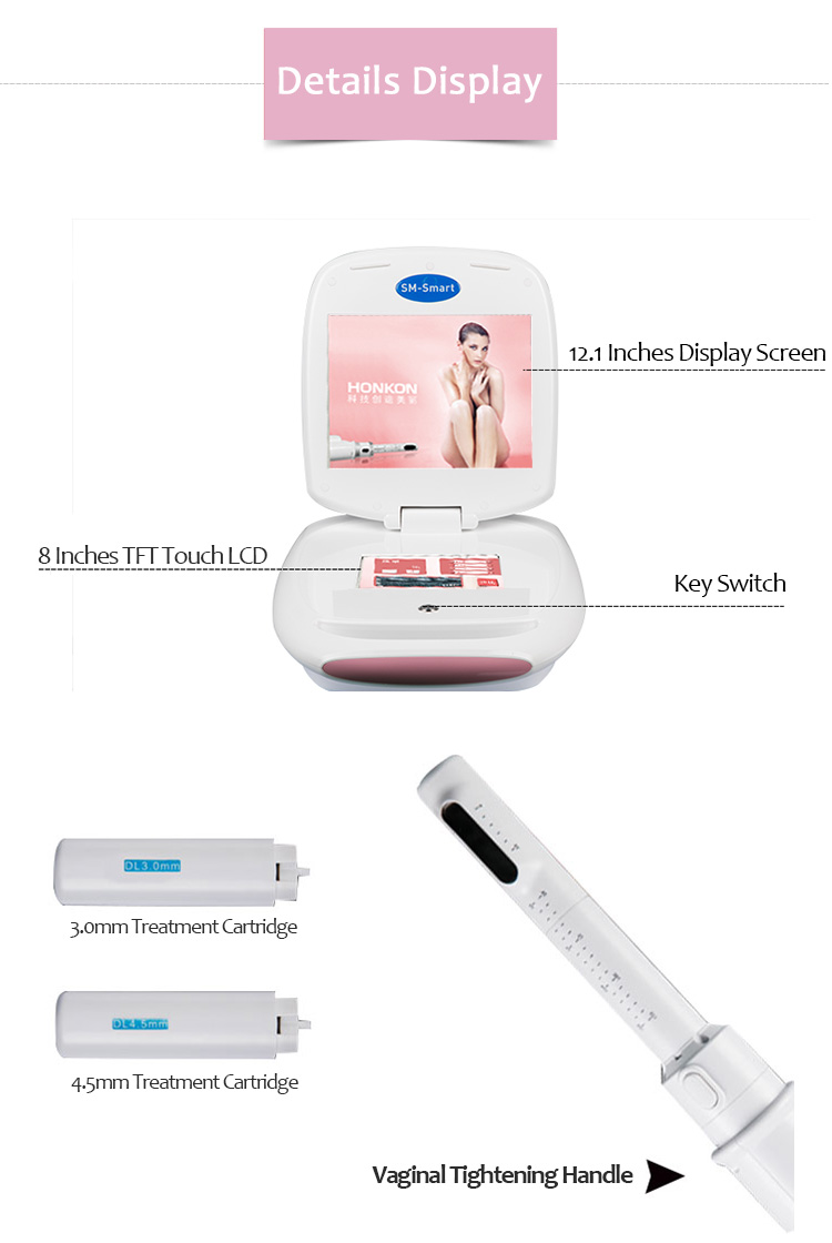 SM-Smart зөөврийн HIFU үтрээ чангалах инвазив бус үтрээний эмчилгээний гоо сайхны машин