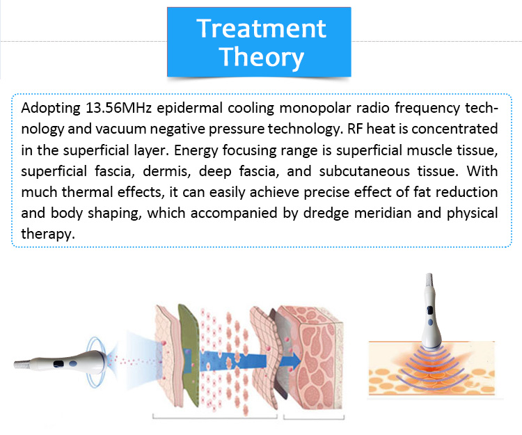 SRS-1 13.56Mhz Epidermal Cooling Monopolar RF Skin Lifting and Tightening Beauty Machine