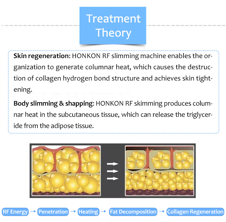 Body Slimming & Cryolipolysis, Body Slimming Machine, Face Lifting Machine, Products, RF Skin Lifting & Tightening, Skin Tightening Machine, SlimmingVII