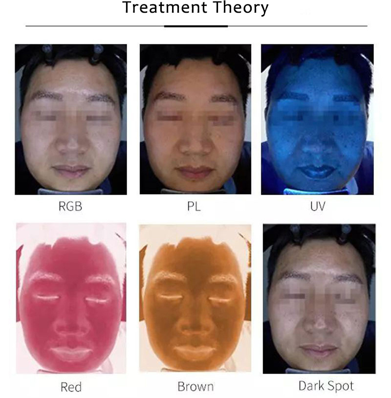 TC-20PLUS Latest Design Six-Spectrum Magic Mirror Skin Analyzer Built-In High Performance Computer