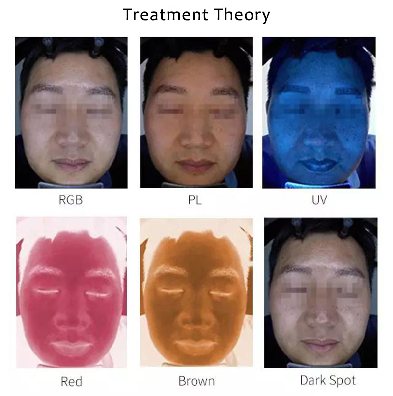 El analizador de cuidado de la piel con espejo mágico facial de seis espectros TC20s analiza las condiciones de la piel del rostro