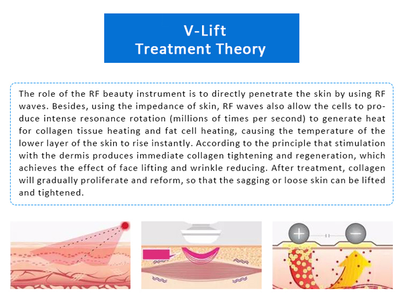 V-LIFT Skin Lifting Skin Tightening Wrinkles Removal Machine