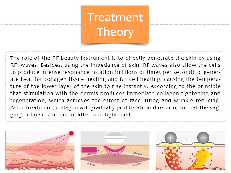 Máquina de rejuvenecimiento facial y cutáneo, Productos, Estiramiento y estiramiento de la piel por radiofrecuencia, Máquina de estiramiento de la piel, V-LIFT++